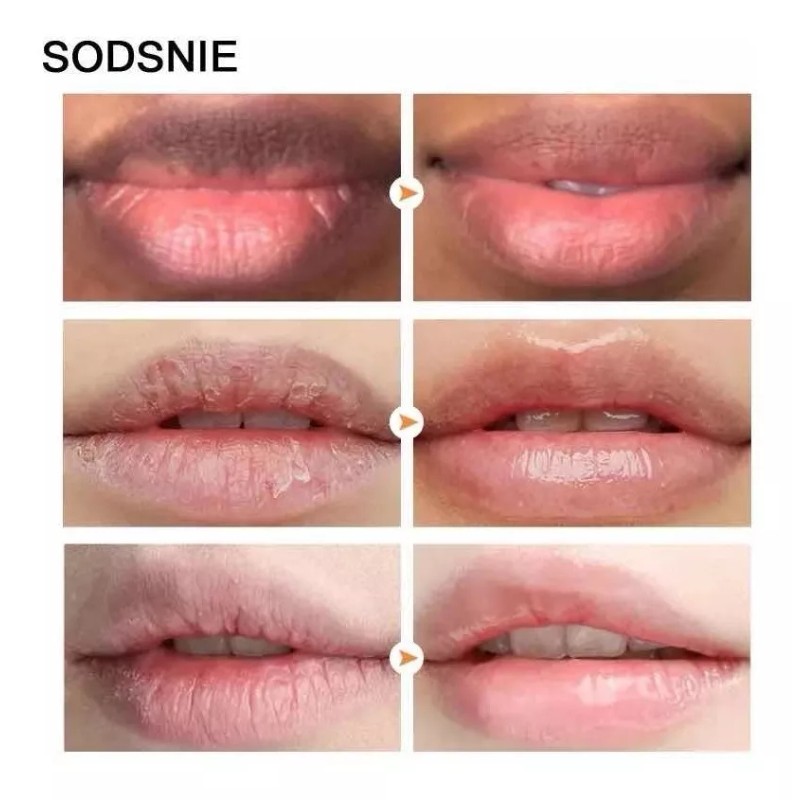 SODSNIE Mascarilla Para Labios Oscuros Aclaradora Para Labios Rosas