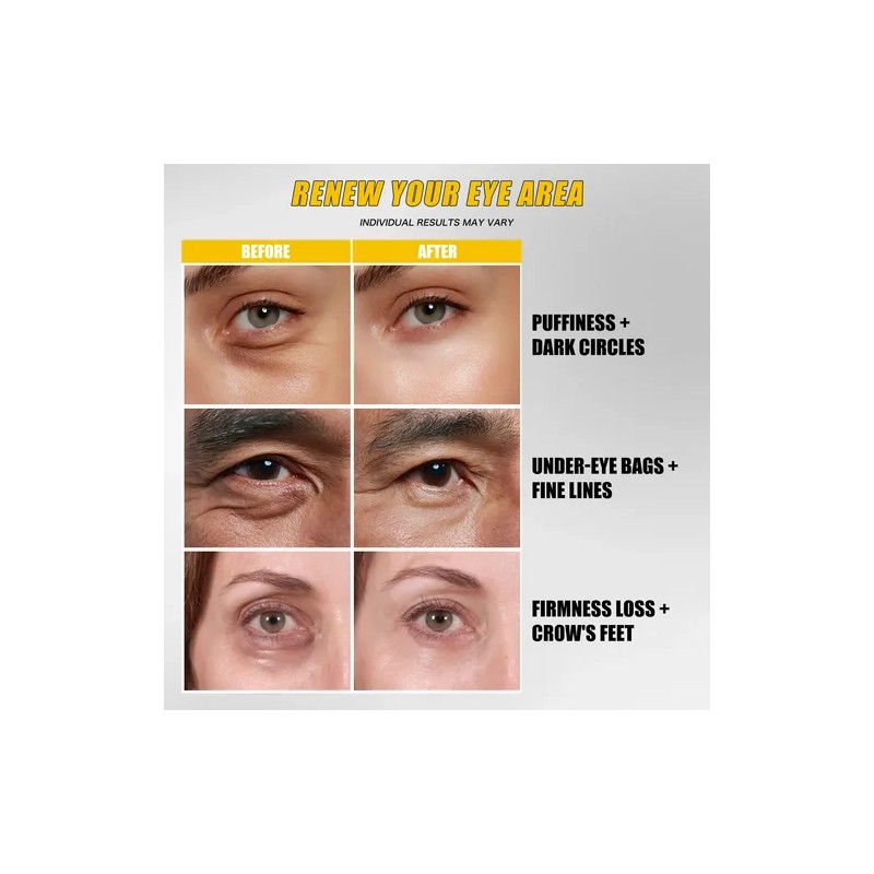 W3W Retinol Crema Quitar Ojeras Potenciador Reafirmante