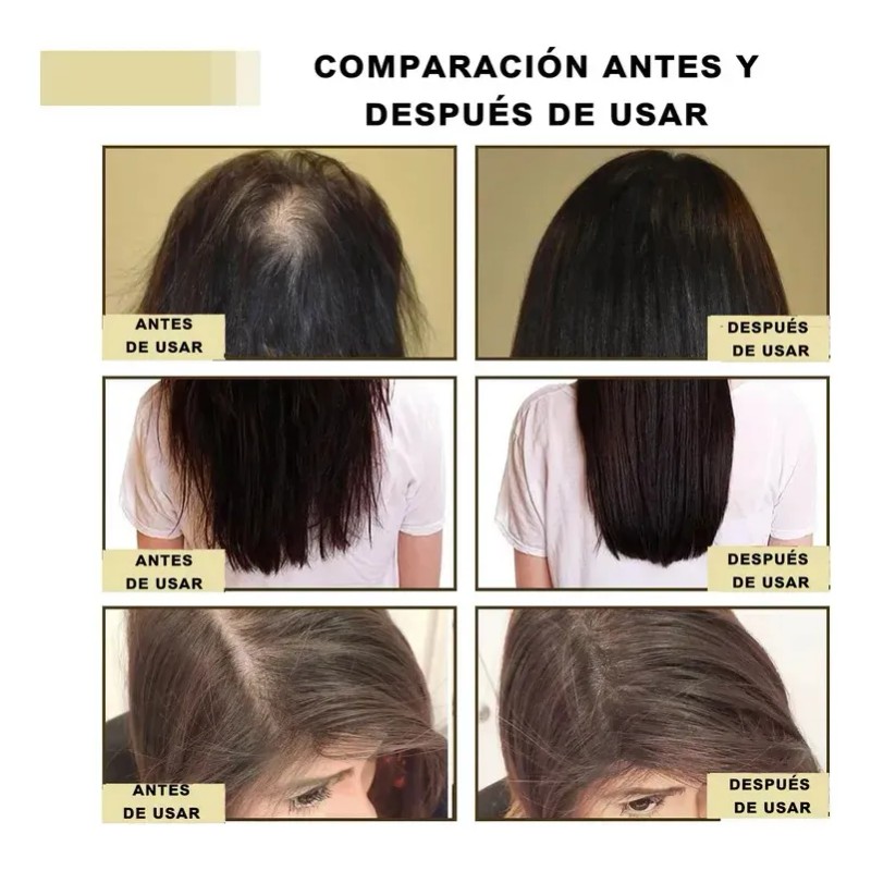 5pzs 60ml Aceite Vegano Natural Para Crecimiento De Cabello