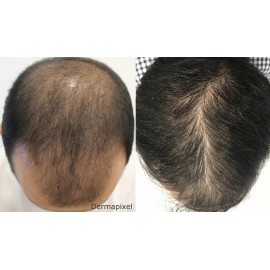 Formula Suiza Para Mas Cabello Barba Bigote Avance Novocrin