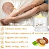 Crema para Venas Varicosas y Araas Vasculares, con Vitamina K,