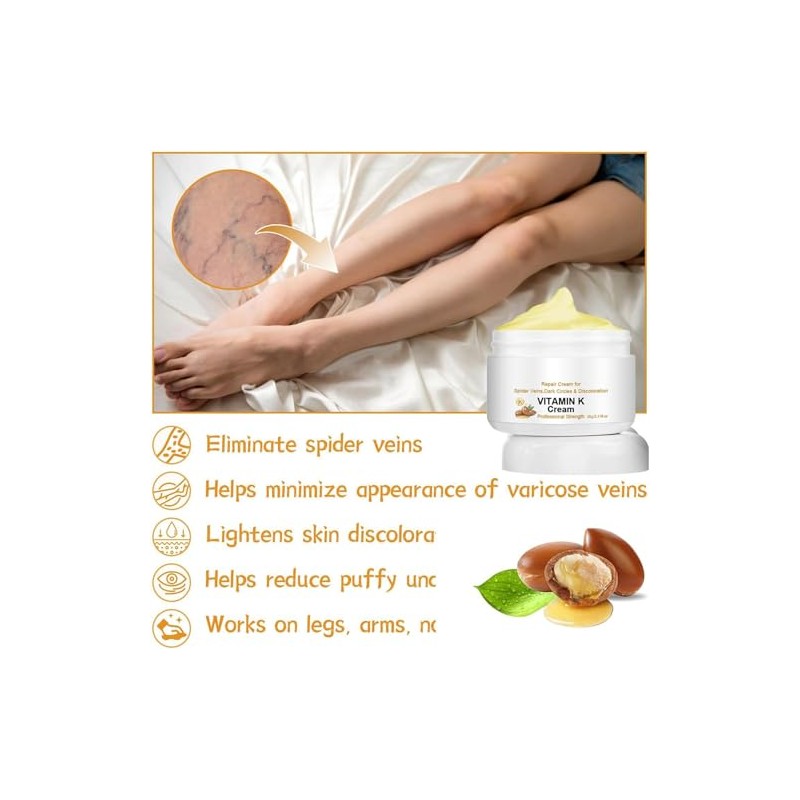 Crema para Venas Varicosas y Araas Vasculares, con Vitamina K,