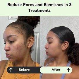 Glorio Detox 8 Tratamientos De Mascarilla Facial Con Arcilla Limpiadora - Arcilla Verde Rara - Set De Belleza De 8 Semanas - Minimiza Poros, Puntos...