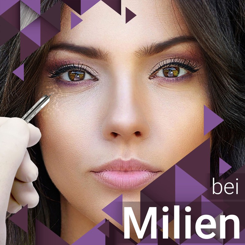 Disposable lancets, lancets, sterile Kosmetex blood lancets