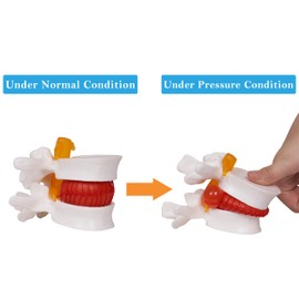 NLShan NLShan Human Anatomical Lumbar Disc Herniation Model, Portable Herniated Lumbar Vertebrae Disc, 1.5 Times Life Size Lumbar Spine Model for Teaching, Learning and Demonstrating