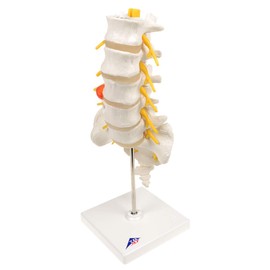 3B Scientific Human Anatomy - Lumbar Spine with Dorsolateral Herniated Disc + Free Anatomy App - 3B Smart Anatomy