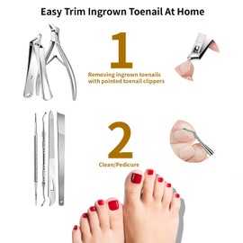 Ingrown Toenail Removal Kit, Precision Series 6-Piece Stainless Steel Ingrown Toenail Kit, Professional Grade Tools for Thick & Ingrown Nails, Home Pedicure Grooming Set with Travel Pouch