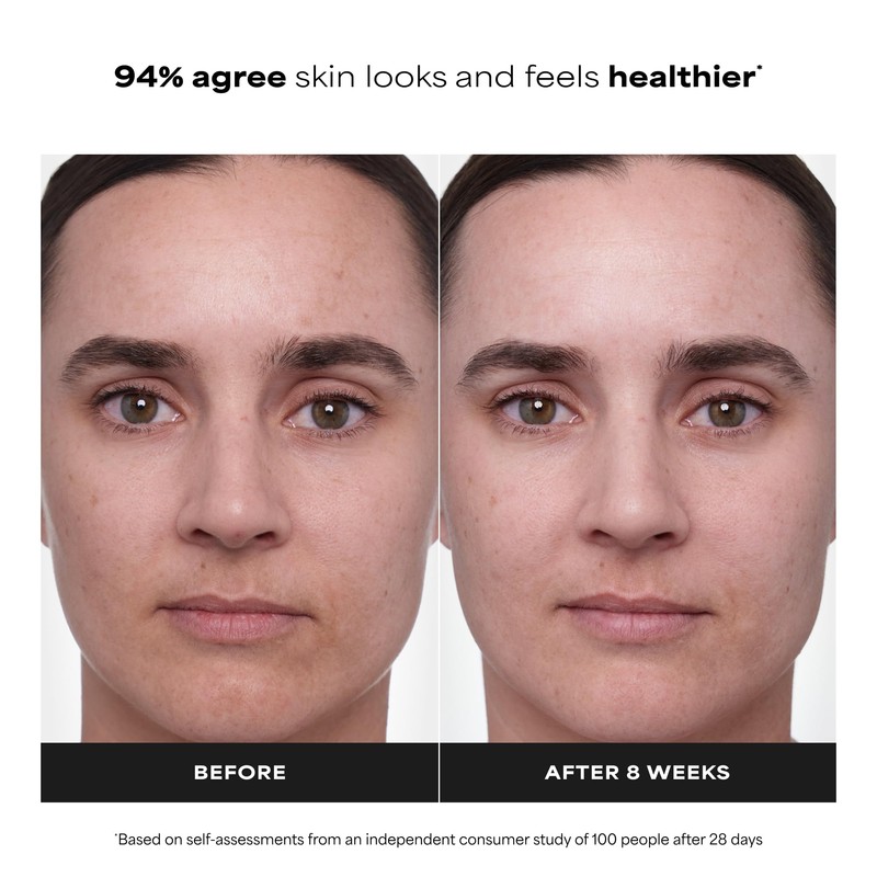 Paula's Choice CLINICAL 1% Retinol Face Treatment with Peptides, Vitamin