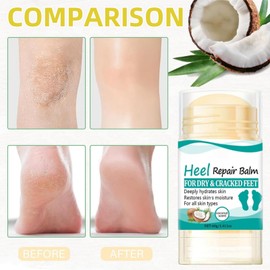 Coconut Heel Balm Stick,Foot Cream for Very Dry Feet,Cracked Heel Repair Cream,Foot Moisturiser,Fo-Ot Cre-Am For Hard Skin,Softening & Removing Hard Skin,Deep Moisturizing,For Body Hands&Feet Knees