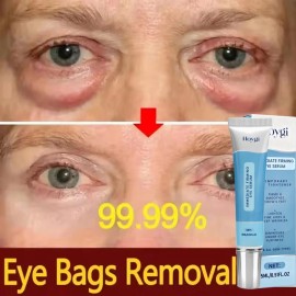 Crema bajo de los ojos para eliminar ojeras bolsas lneas faciales arrugas eternas ojos hinchados-                                                     