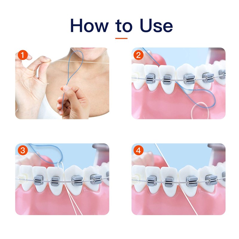 VINSULLA Floss Threaders for Braces, Bridges, and Implants (50 Count
