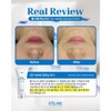 Ételan Etelang Water Cream Mask 100ml Hypoallergenic Daily Moisture Pack