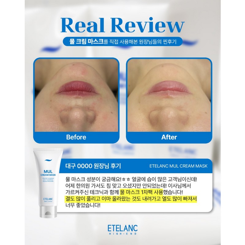 Ételan Etelang Water Cream Mask 100ml Hypoallergenic Daily Moisture Pack