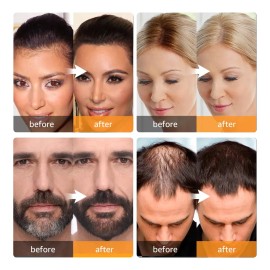 Polvo De Retoque Hair Root Abomet Instant Gray Coverage