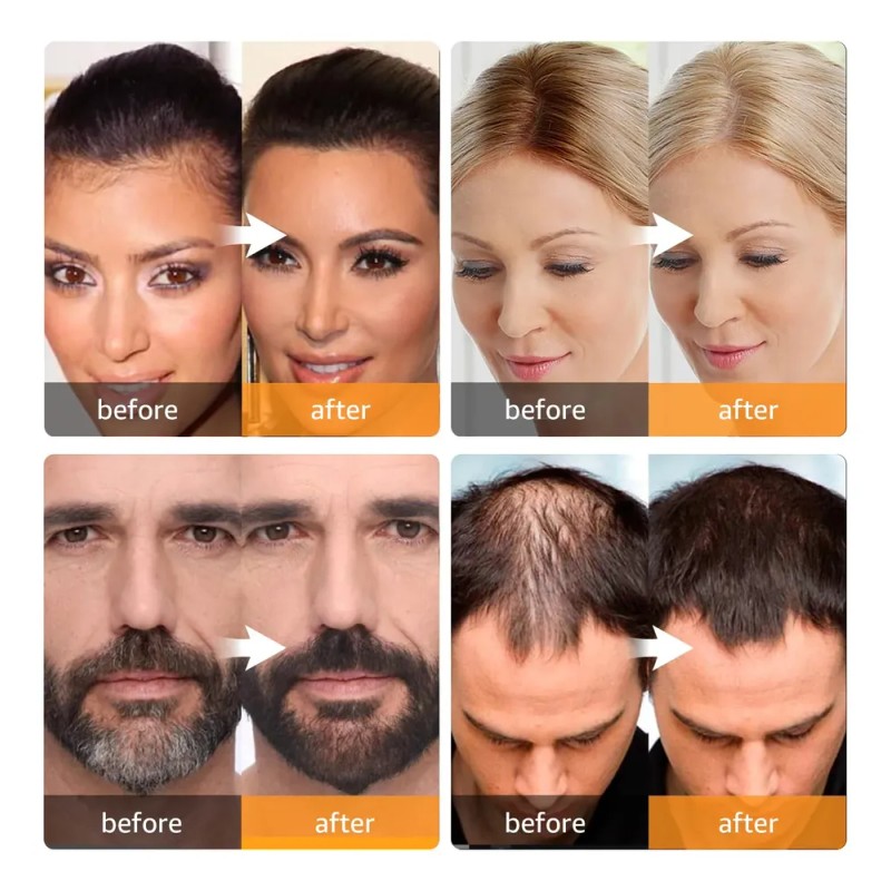 Polvo De Retoque Hair Root Abomet Instant Gray Coverage