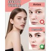 200 Pcs Parches para Granos, Parches Granos Estrella, Con Aceite