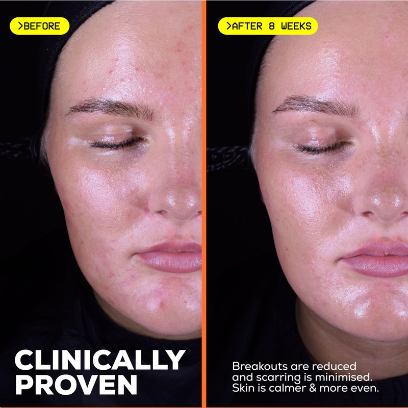 Glow Hub The Scar Slayer Facial Serum with Vitamin C