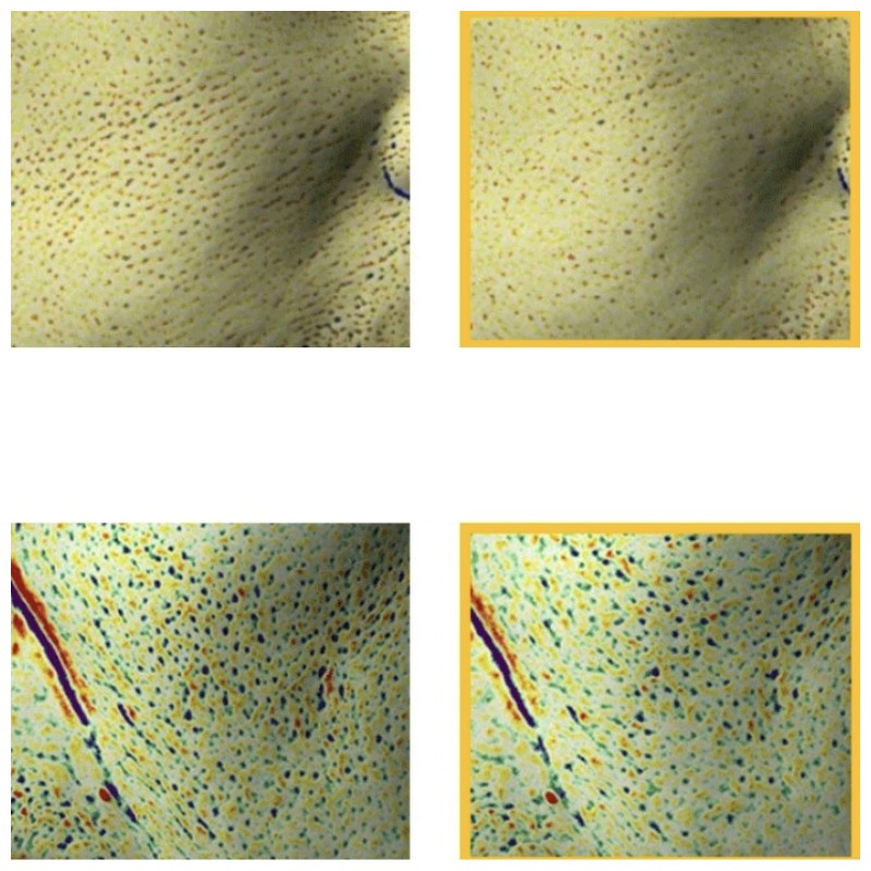 DERLADIE Pore Slowaging Banatinol Ampoule 30ml