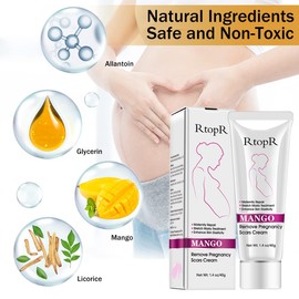 Fengyang® Dehnungsstreifen Creme, Narbencreme Entfernung Creme, Dehnungsstreifen Entfernen, Dehnungsstreifen Reparatur Creme, Dehnungsstreifen, Stretch Marks Removal,40g