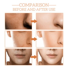 Frankincense Essential Oil for Face & Body,Frankincense Oil,Fra/nkincense Resin Oil,Reduces Fine Lines & Wrinkles,Frankinc/ense Resin O/il for FA/ce,Frankince/NSE Oi/l for Skin Fac/e,Body O/il