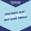 Clearasil Rapid Action Pimple Cream 15ml
