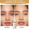 2 Pieces Dark Spot Serum Turmeric Oil for Skin 30ml