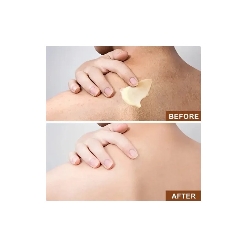 Manteca De Karité Para Piel Seca Y Cabello, Hidratación Prof