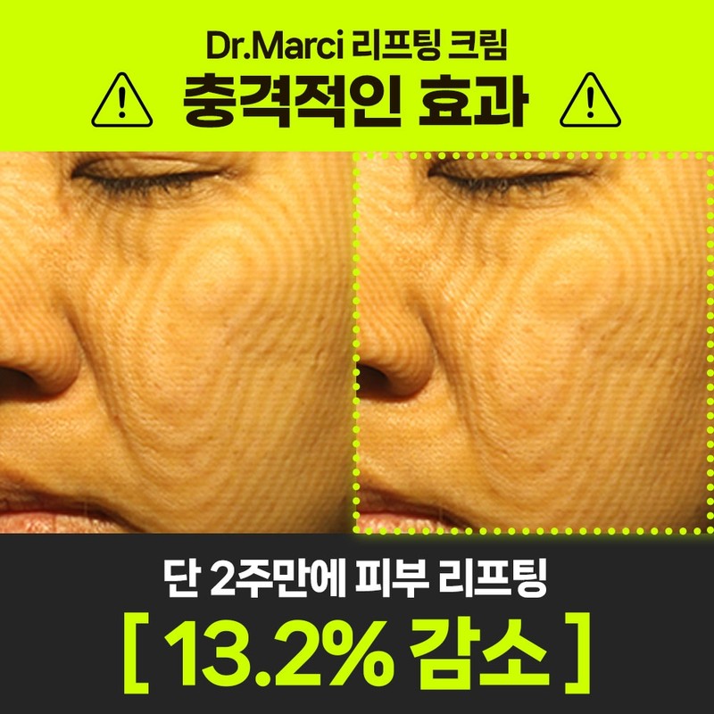 Dr. Marci Innofting Cream Elasticity 37% Collagen Lifting Ceramide Dexpanthenol