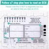 ECG 7 Step Ruler, ECG Plastic Ruler, Transparent EKG Pocket