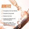 Sérum Para El Crecimiento Del Cabello Abera Para La Caída