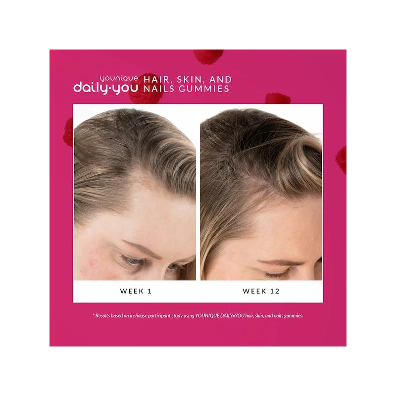 Gomitas Para Cabello, Piel Y Uñas Younique Daily·you