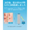 Winner クレンジングタオル 厚手 フェイスタオル 使い捨て OEKO-TEX®認証 100%コットン ふきとり用 フェイスペーパー 使い捨てタオル