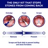 ORAVIX Tonsil Stone Remover - Tonsil Stone Removal Kit -