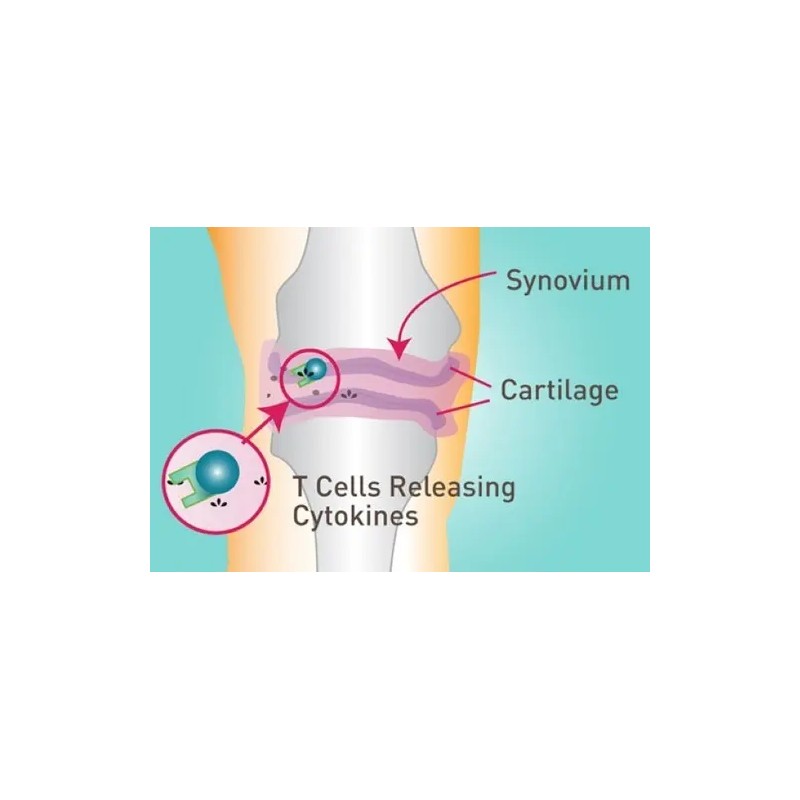 Schiff Move Free Ultra Triple Accion Cápsulas Capsulas