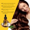 OUHOE Ginger Treatment Oil for Hair Growth,Hair Growth Serum,Biotin Hair
