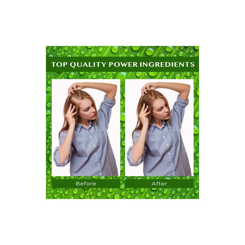 Sérum Para El Crecimiento Del Cabello Essynaturals Advanced