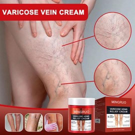 MINGRUO Varicose Veins Cream, Creme gegen Krampfadern, Besenreiser Creme, Krampfadern und Besenreiser Entfernen, Besenreiser-Pflegecreme, Krampfadern Creme für die Beine