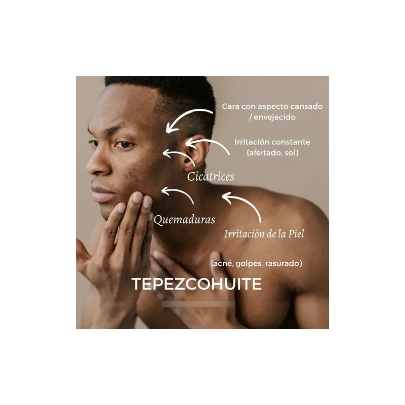 Crema De Tepezcohuite Fórmula Natural Regeneración Cutánea