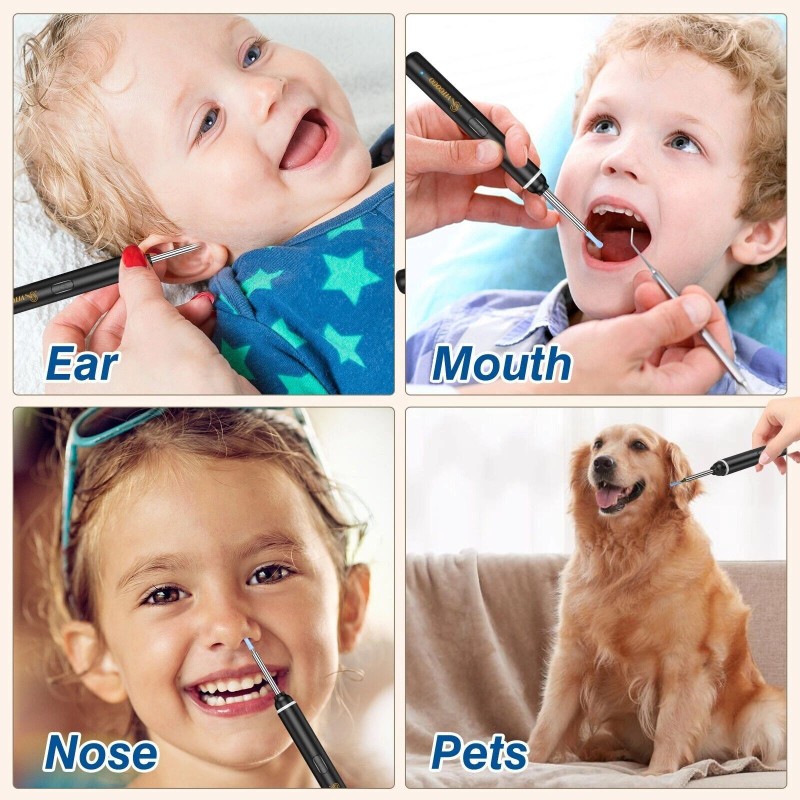 VITCOCO HD Ear Scope with Camera - 1920P WiFi Otoscope