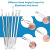 Blackhead Remover Tools, 15 PCS Pimple Popper Tool Kit, Acne