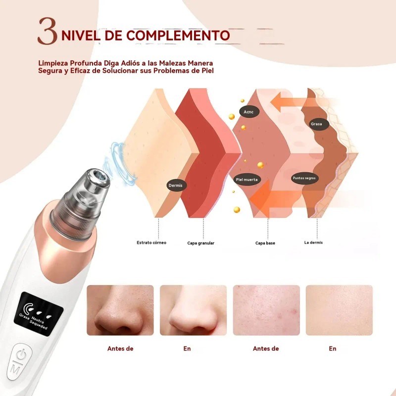 Limpiador De Poros Extractor De Puntos Negros Y Acné Facial