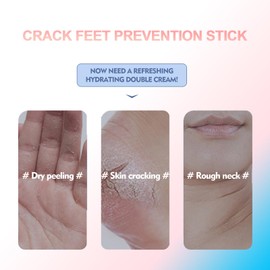 santiramo Eourhsa Crack Feet Prevention Stick, Eourhsa Foot Balm, Eoursha Crack Heel Cream -Smooth Protective BalM, Foot Balm for Dry Cracked Feet, Refreshing, Hydrating, Deep Moisturizing (Pink+Blue, one size)