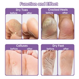 2 Pairs Foot Peel Mask for Hard Skin,Lavender Exfoliating Mask for Callus Remover Dead Dry Skin,Cracked Heel Treatment Socks, Plant Formula Moisturising Socks, Soft Foot Care