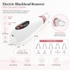 USB Rechargeable Blackhead Remover – Adjustable Suction Pore Vacuum Cleaner
