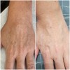 Crema De Noche Anti Acné Paño Y Manchas + Agua