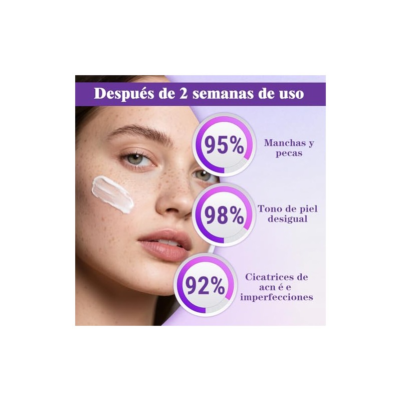 Crema Epiglow Melanex Advanced Anti-Hiperpigmentación