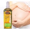 Palmers Pack Aceite Crema Balsamo Prevenir Estrias Embarazo Posparto