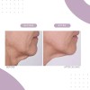 Serious Skincare Reverse Lift Correc-chin - Crema Reafirmant