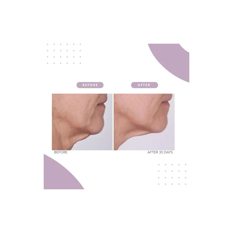 Serious Skincare Reverse Lift Correc-chin - Crema Reafirmant