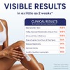 Palmer's Skin Success Fade Milk - Loción Corporal Aclarante, Dermatológicamente